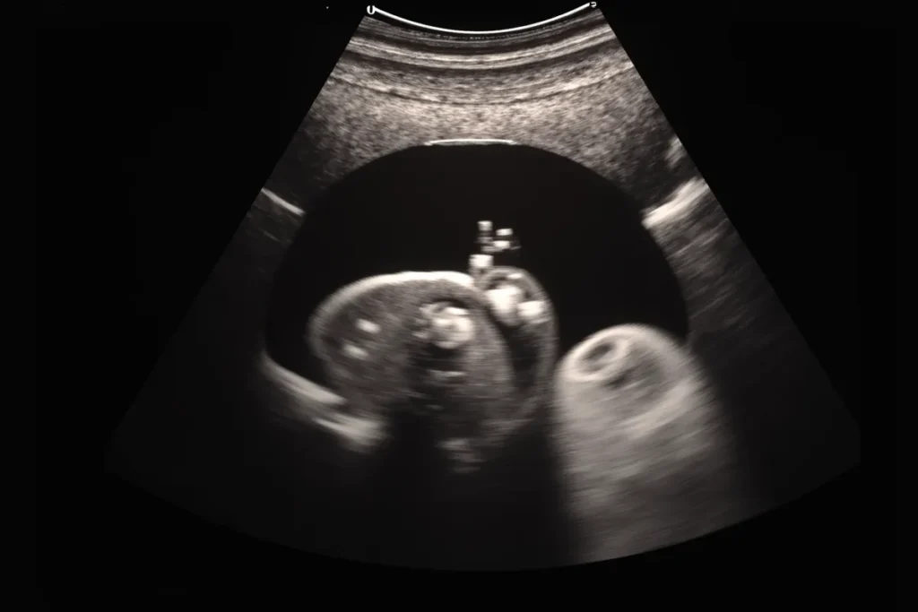 Kiedy widać ciążę na USG? Przewodnik dla przyszłych mam